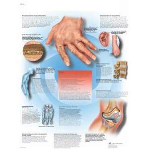 Rheumatic Diseases 20 x 26 in.   Paper version  Industrial 