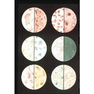 3B Scientific V2041M Bacteria Anatomical Chart, with Wooden Rods 