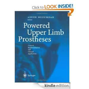 Powered Upper Limb Prostheses Control, Implementation and Clinical 