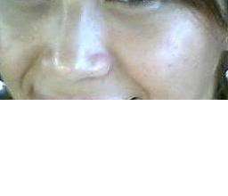 Skin Lightening Whitening Bleaching Cream Face M  